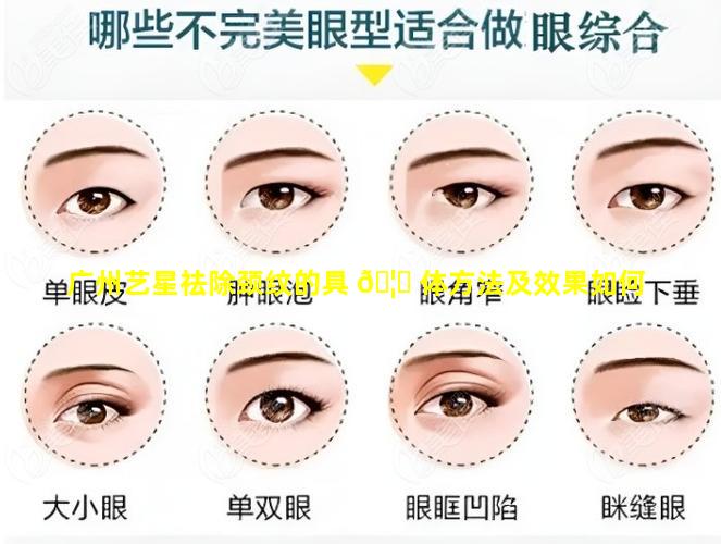 广州艺星祛除颈纹的具 🦅 体方法及效果如何